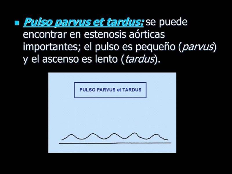 Pulso parvus et tardus: se puede encontrar en estenosis aórticas importantes; el pulso es